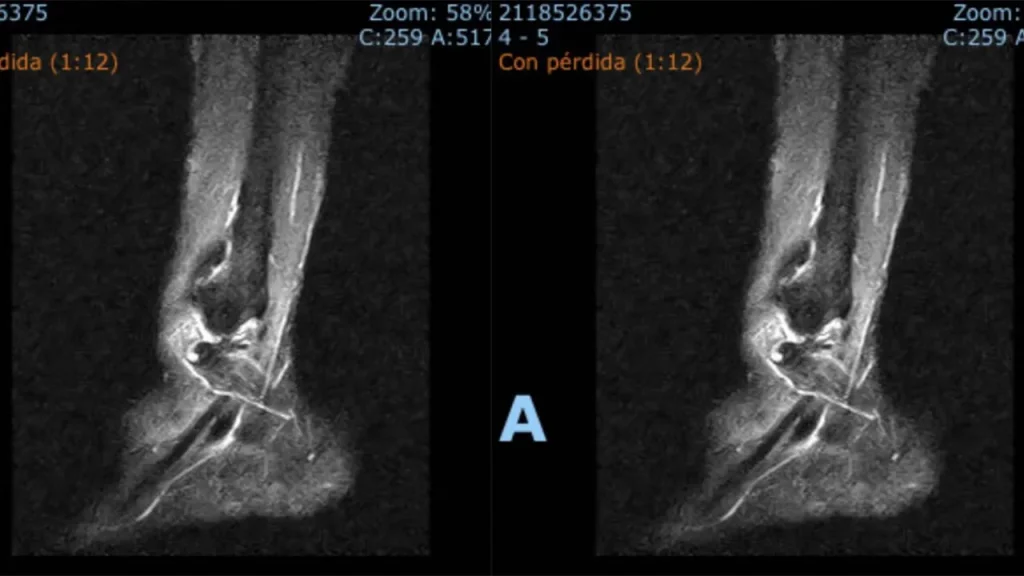 Imágenes de la fractura de tobillo Fernando Adrián